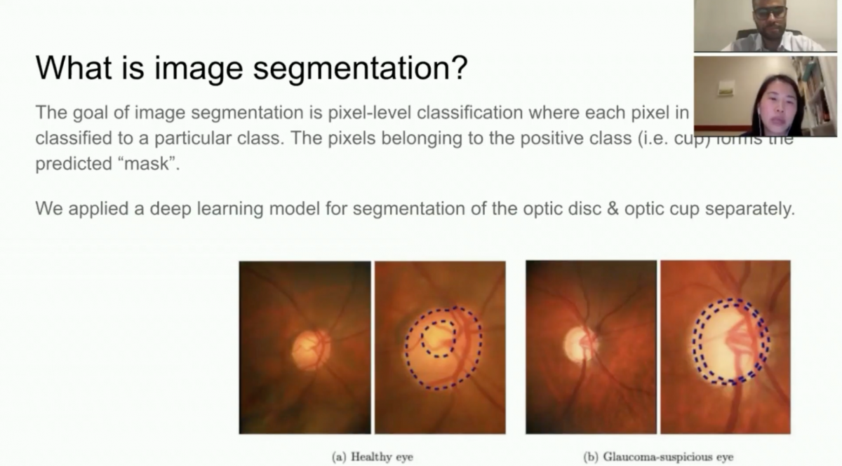 Johnson & Johnson: AI-Assisted Estimation of Cup to Optic Disc Ratio from Human Retina Images in the Google Cloud Platform